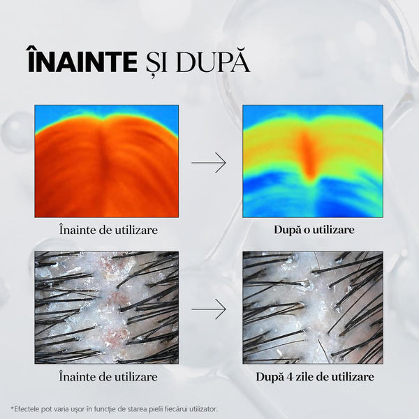 Ser Coreean pentru Scalp cu PDRN – Întărește Rădăcinile, Reduce Ruperea Firului