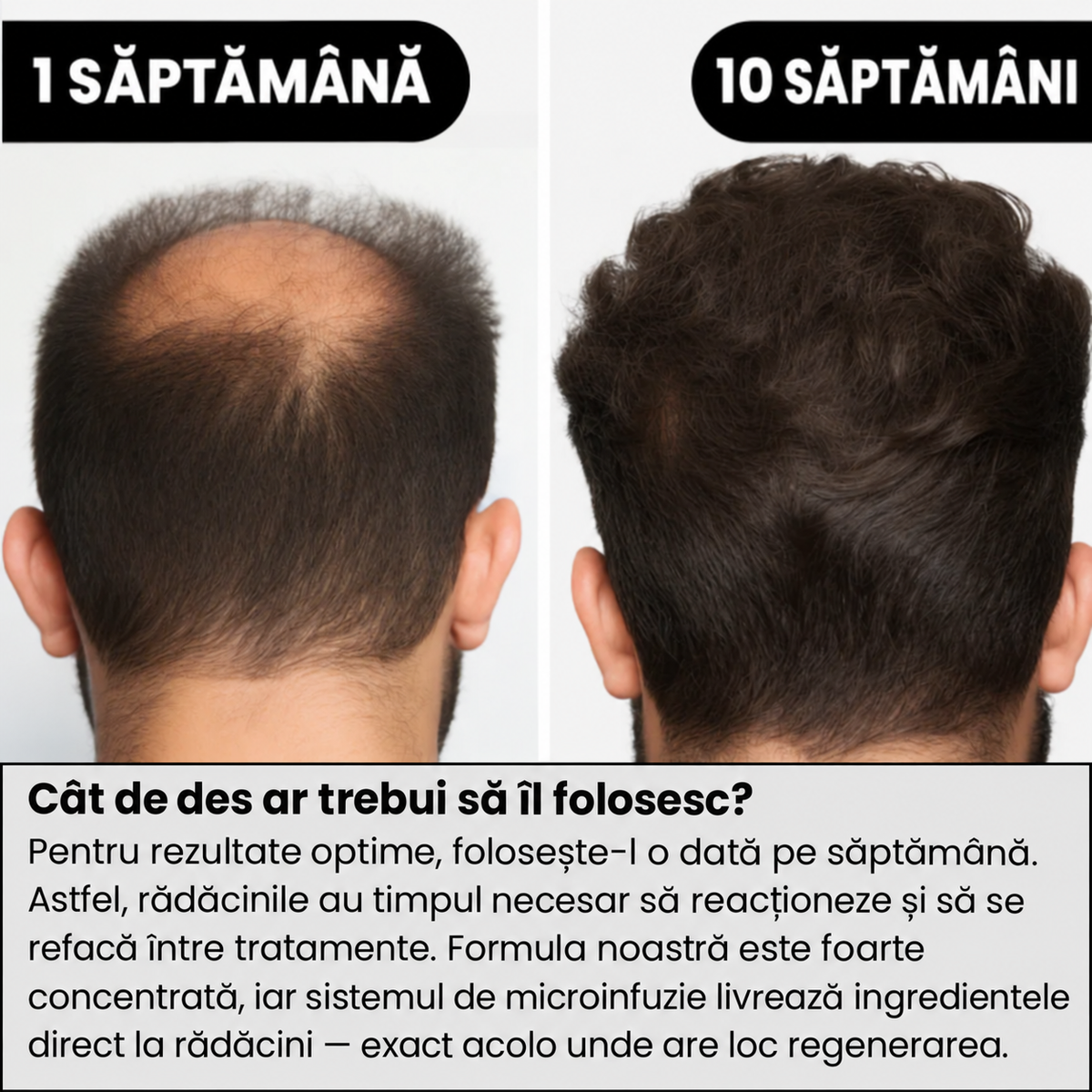 Păr vizibil mai des în
